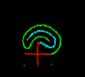 Connect the right of the plus with the right top dot